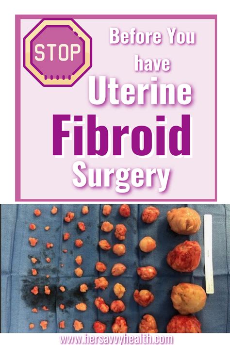 endometriosis or uterine fibroids