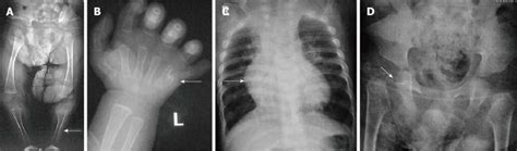 Image result for Graphical Abstract Examples of a Process