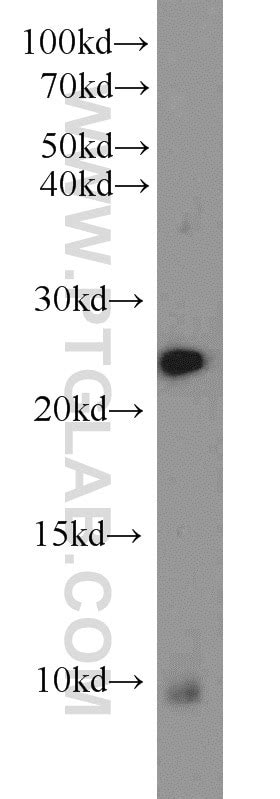 RAN antibody (10469-1-AP) | Proteintech