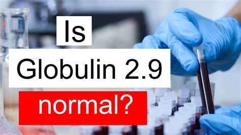 Is Globulin 2.9 normal, high or low? What does Globulin level 2.9 mean?