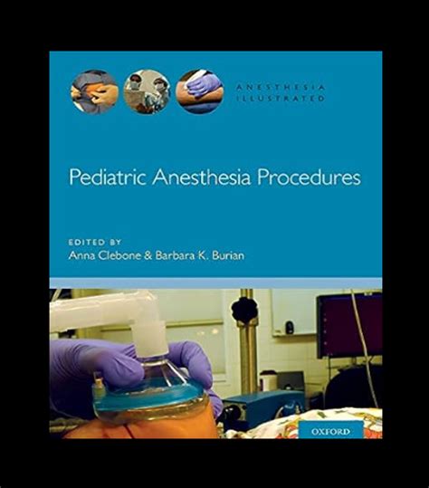 Pediatric Anesthesia 的图像结果