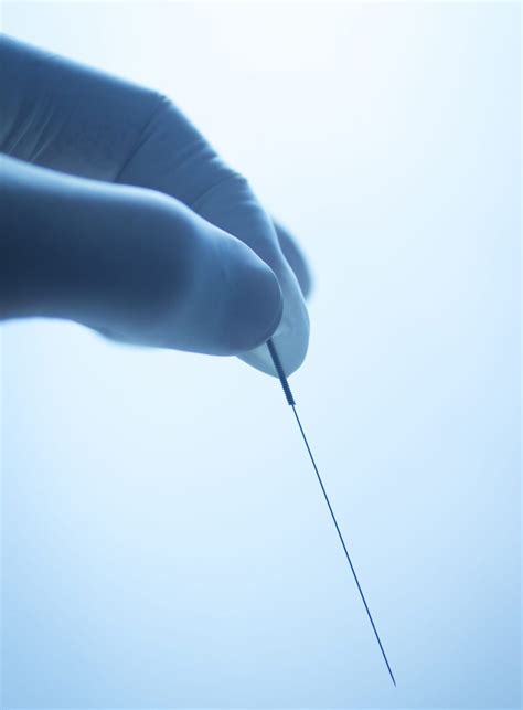 Integrative Dry Needling - Beyond Trigger Points - Elite Bodyworks