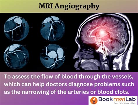 MRI Angiography Price - Book Online at Top Radiology Centers