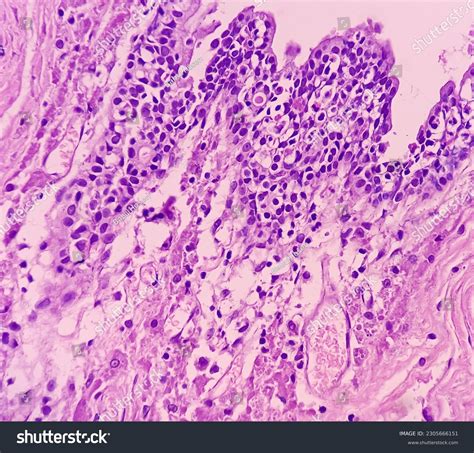 Skenes Gland Histology