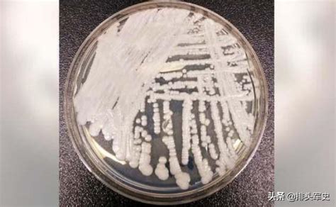 随时会致命！美本土爆发“超级真菌”，CDC报告曝光：已无药可治 -6park.com