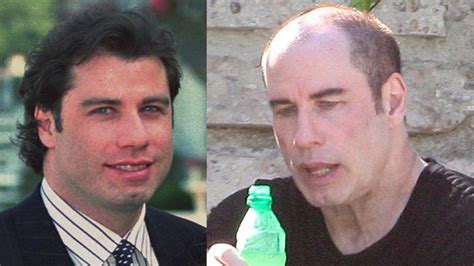 Hair Today, Gone Tomorrow: Hollywood Stars Going Bald | Fox News