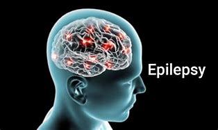 Epileptic 的图像结果