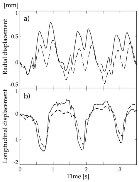 Iterative 2D Tissue Motion Tracking in Ultrafast Ultrasound Imaging