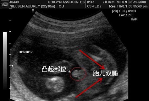 怀孕肚子变化过程图 (49)_有来医生