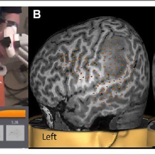 Image result for Language Mapping Scan