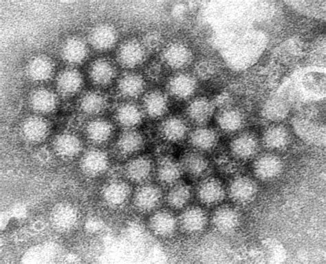 Vaxart's oral norovirus vaccine shows promise in Phase 1 clinical ...