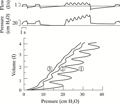 Pressure Volume Curve
