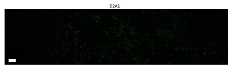 The Dynamic Relationship of Breast Cancer Cells and Fibroblasts in ...