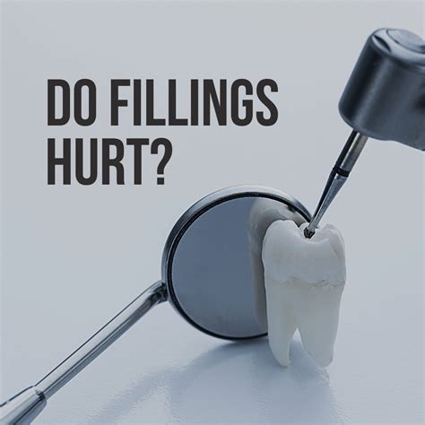 Do Fillings Hurt? | McLean, VA | Smile Mclean Dentistry