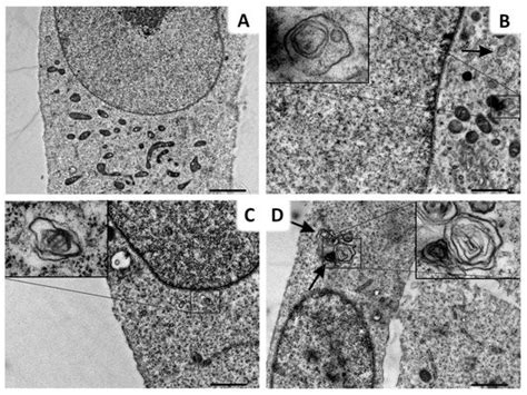 A Potent Autophagy Inhibitor (Lys05) Enhances the Impact of Ionizing ...