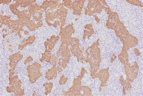 Image result for Scade Probe Example