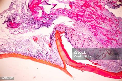 Image result for Finger Under Microscope