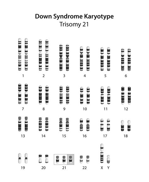Image result for What Is Code Block in Java