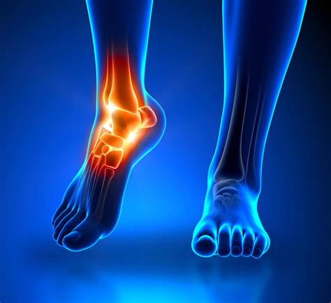 Who Else Wants Tips About How To Deal With Ankle Pain - Servicecomplex10