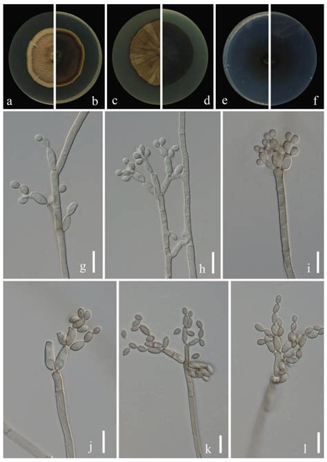 Cladosporium Species Associated with Fruit Trees in Guizhou Province, China