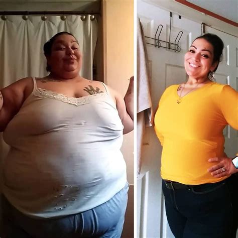 500-Pound Woman Had to Lose 300 Pounds or Suffer Pain for Rest of Her ...