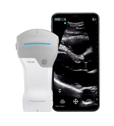 GE Healthcare Vscan Air Portable Ultrasound Systems