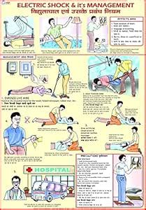 Electric Shock & It's Treatment Chart English and Hindi (A3) Wall Chart ...
