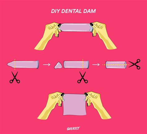 Dental Dam Tray Set Up at Hamish Payne blog