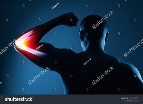 4,721 Rheumatic Xray Images, Stock Photos & Vectors | Shutterstock