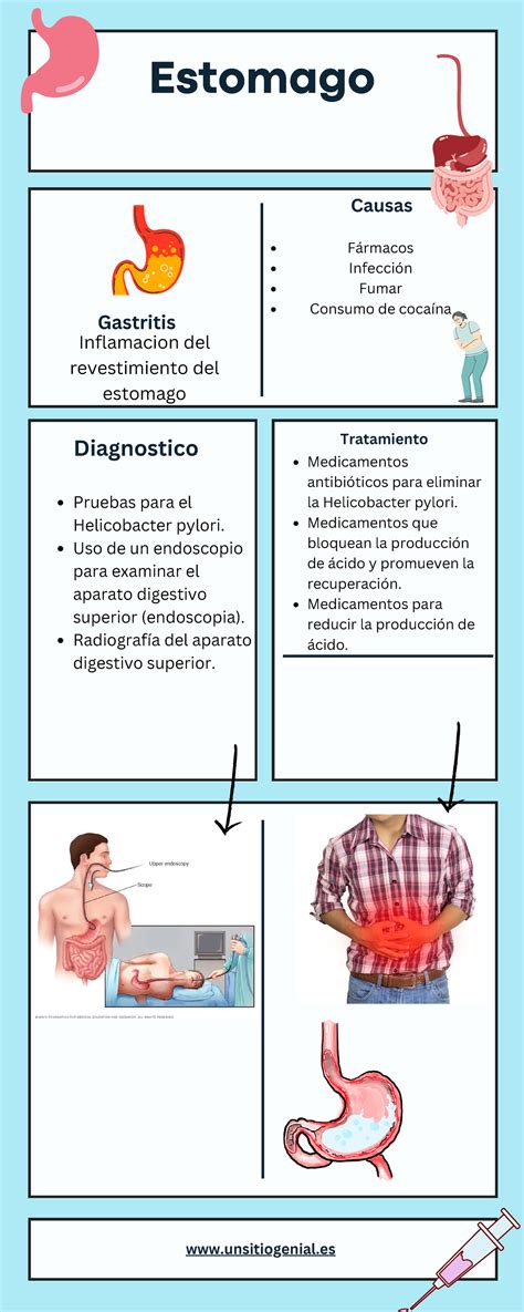 Infografía sistema digestivo - Estomago Inflamacion del revestimiento del estomago Gastritis ...
