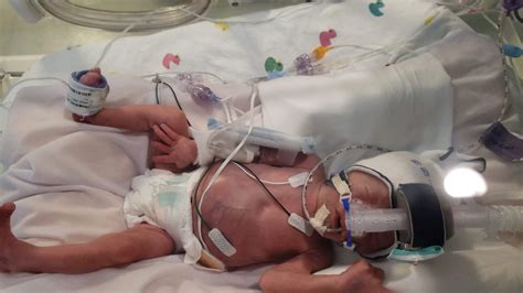 Born At 29 Weeks Pregnant