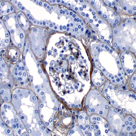 COLLAGEN TYPE IV - CO4P | PathnSitu Biotechnologies