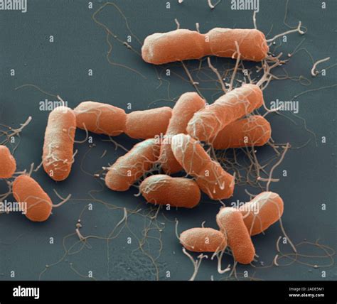 Proteus mirabilis bacteria, coloured scanning electron micrograph (SEM ...
