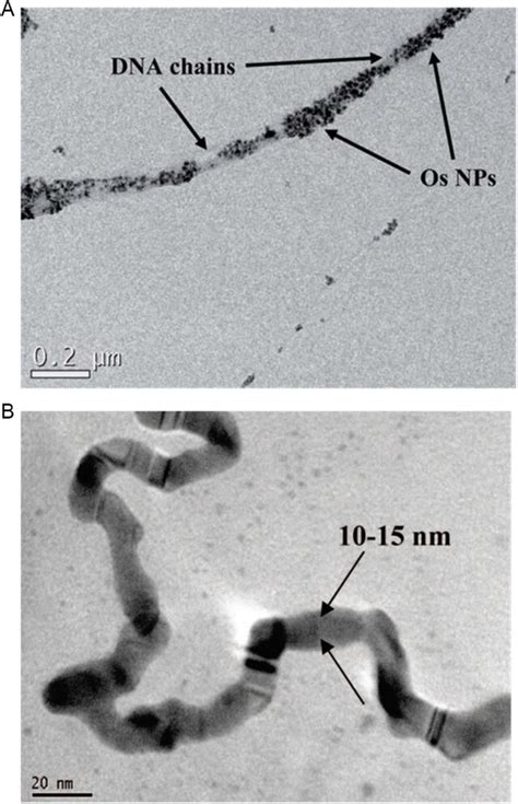 DNA Electron Microscope 的图像结果