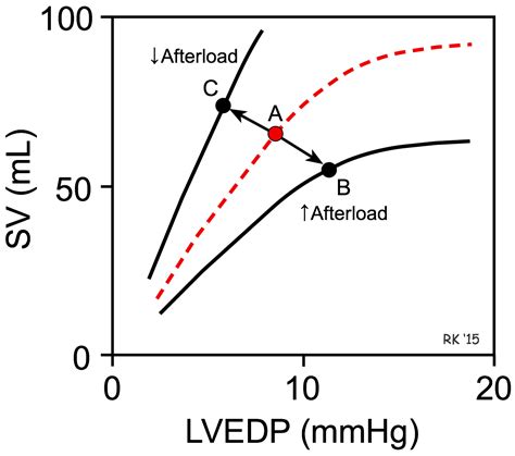 CV Physiology | Cardiac Afterload