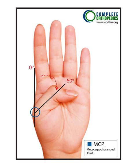 Upper Extremities – Thumb and Fingers | Best Hip & Knee Surgeon | NY, USA