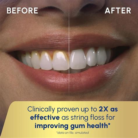 Waterpik Aquarius Water Flosser For Teeth Cleaning, India | Ubuy