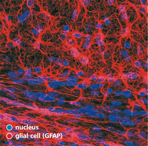Immunostaining pictures | Mallika | Annals of Neurosciences