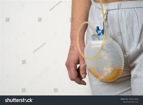 3,078 Post Surgical Images, Stock Photos & Vectors | Shutterstock