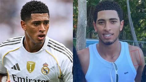 Jude Bellingham muestra la cicatriz de la cirugía de hombro mientras el ...