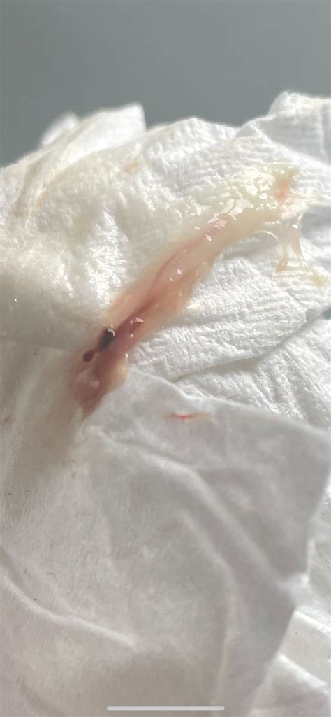 Bloody Discharge Pregnancy