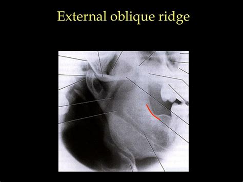 PPT - Mastering Lateral Oblique Projection in Dental Radiography Guide ...