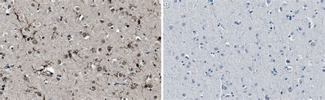 Anti-P2RY12 Antibody, clone 10B5.3.27 | Sigma-Aldrich