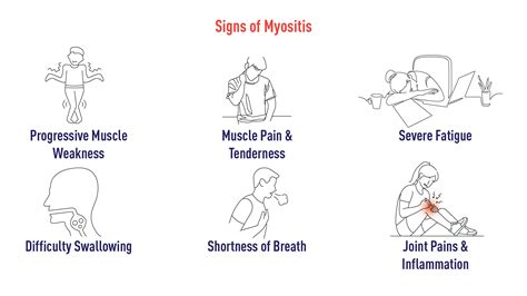 Myositis: Types, Symptoms, Causes, Diagnosis & Treatment