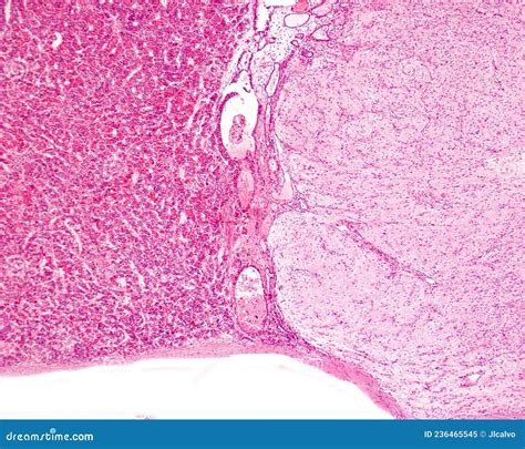 Human Pituitary Gland. Intermediate Lobe Stock Image - Image of body, glandular: 236465545