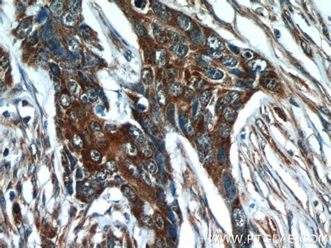 Cytokeratin 18 antibody (18708-1-AP) | Proteintech