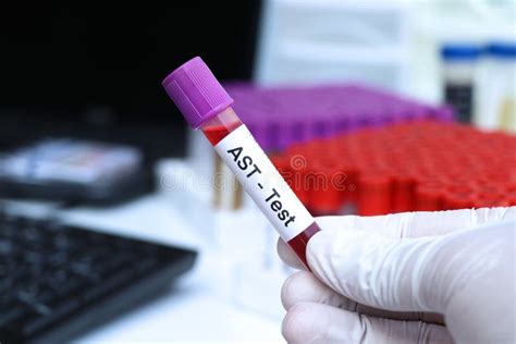 AST Blood Test 的图像结果