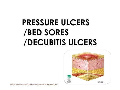 Bed Sores - Pressure Ulcers - Dr Rohit Bhaskar | PDF | Skin and Dermatology | Diseases and ...