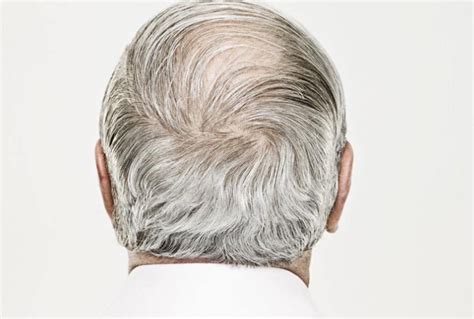 白发变黑发的实用妙方-百度经验