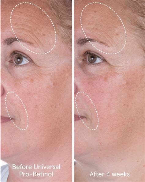 Universal Pro-Retinol – Glossier